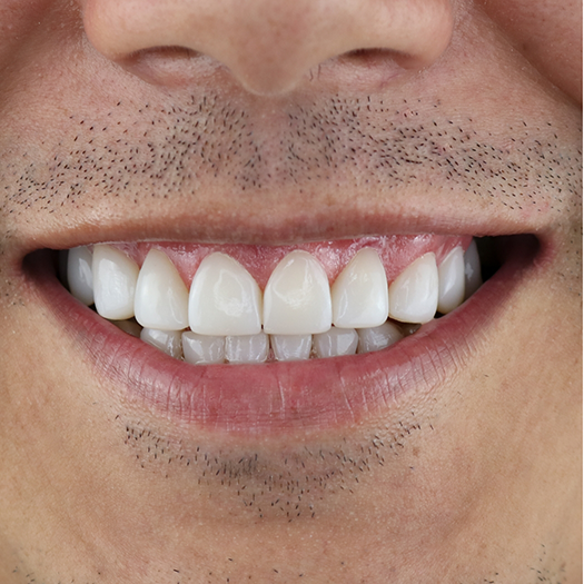 Close up of man with shaved moustache smiling