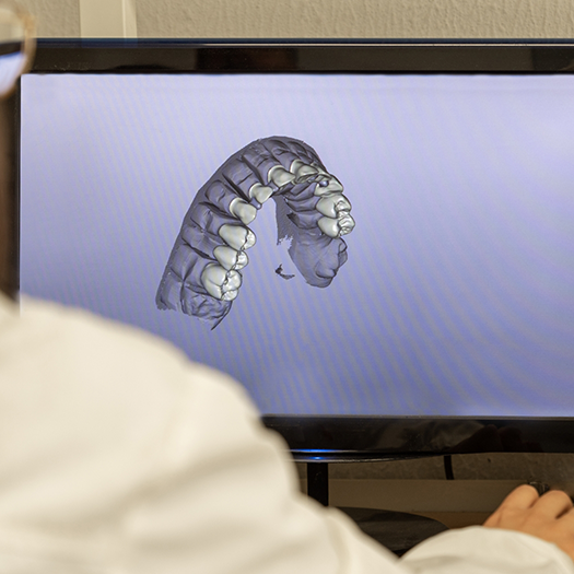 Three dimensional model of teeth on monitor