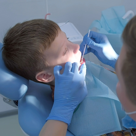 Applying fluoride to a childs teeth