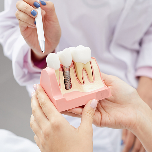 Patient holding dental implant model and dentist pointing to it with pen